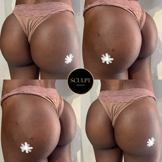 Sculptra